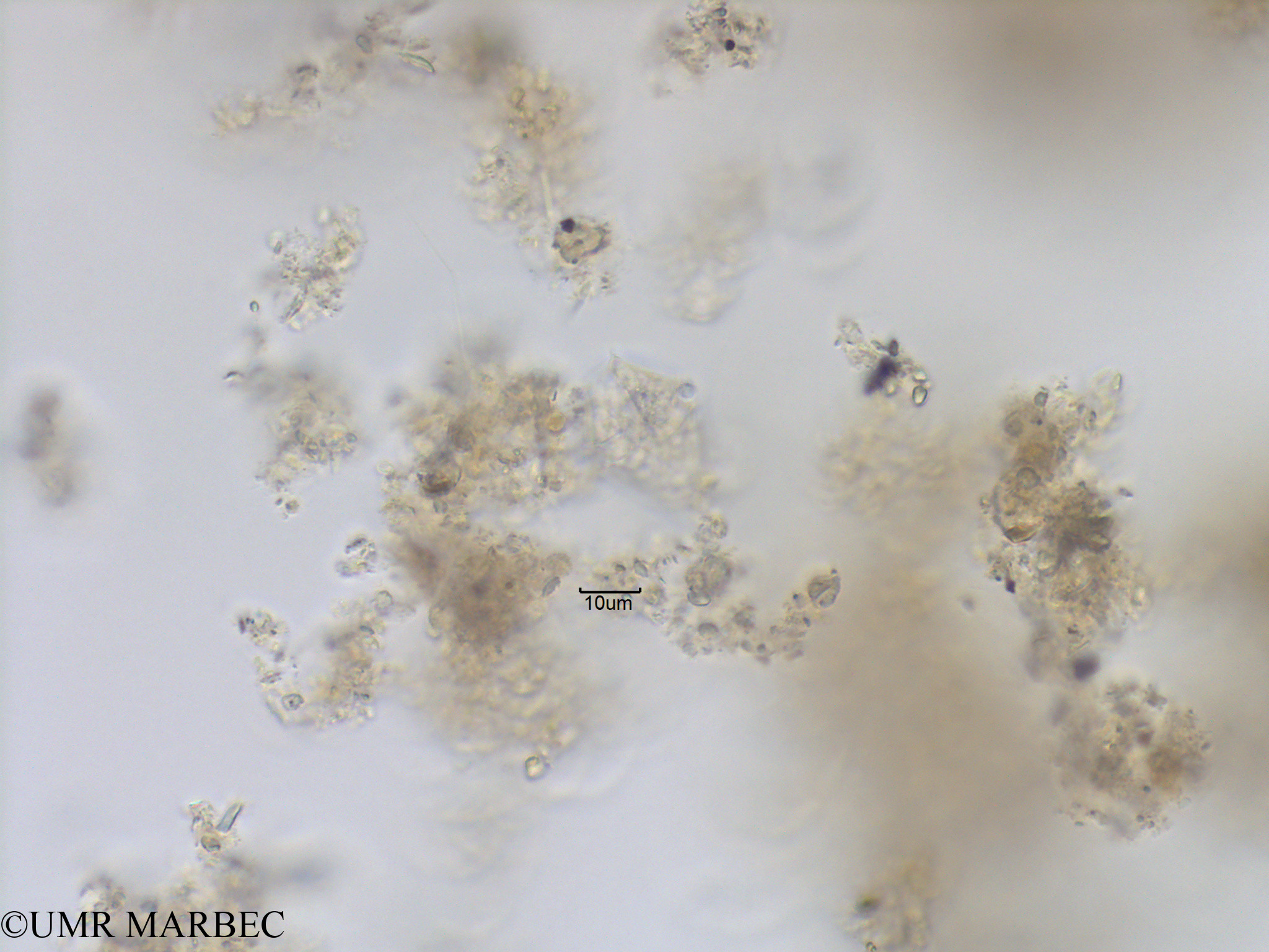 phyto/Bizerte/bizerte_lagoon/RISCO November 2015/Scrippsiella spinifera (Protoperidinium sp15-Lagune_T5_CW3-Proto allongé-3).tif(copy).jpg